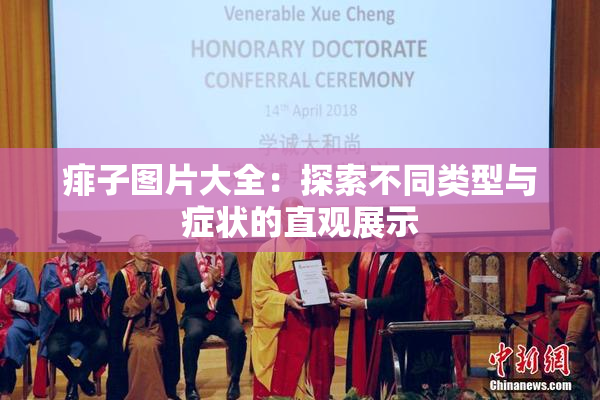 痱子图片大全：探索不同类型与症状的直观展示