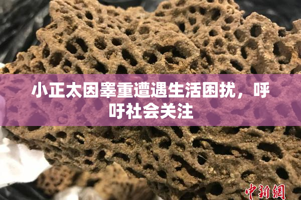 小正太因睾重遭遇生活困扰，呼吁社会关注