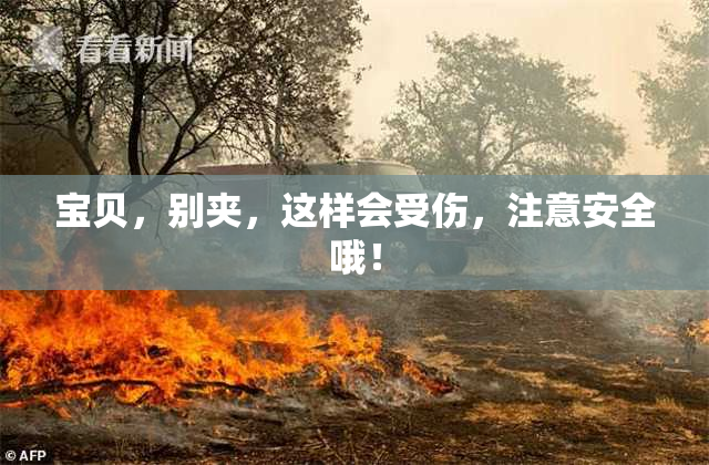 宝贝，别夹，这样会受伤，注意安全哦！