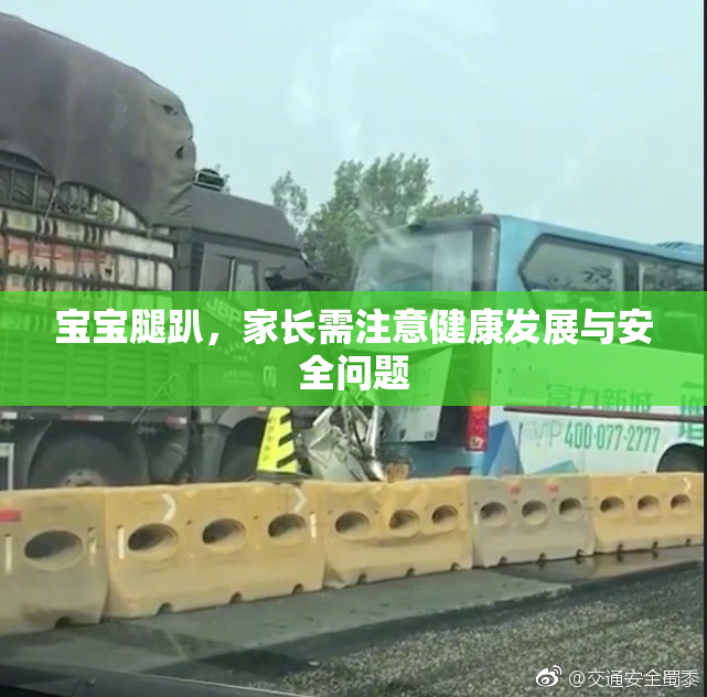 宝宝腿趴，家长需注意健康发展与安全问题