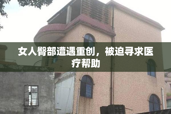 女人臀部遭遇重创，被迫寻求医疗帮助