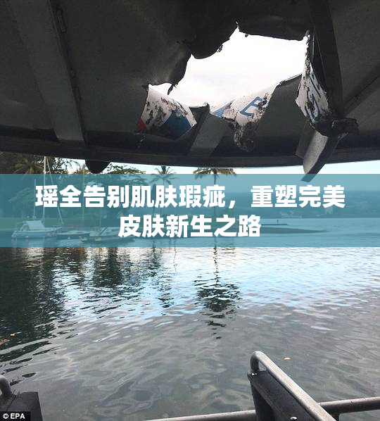 瑶全告别肌肤瑕疵，重塑完美皮肤新生之路