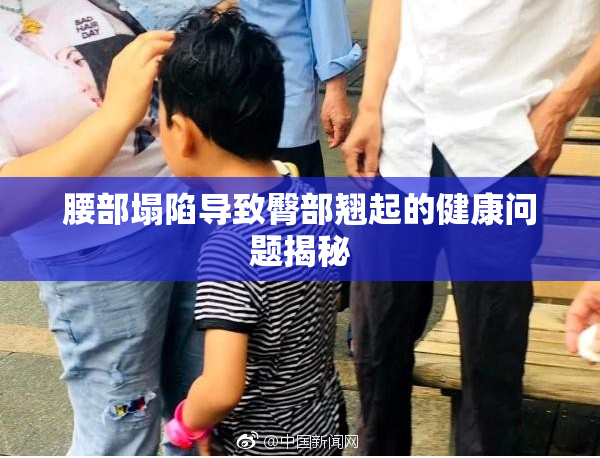 腰部塌陷导致臀部翘起的健康问题揭秘