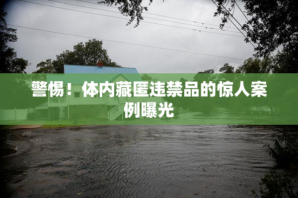 警惕！体内藏匿违禁品的惊人案例曝光