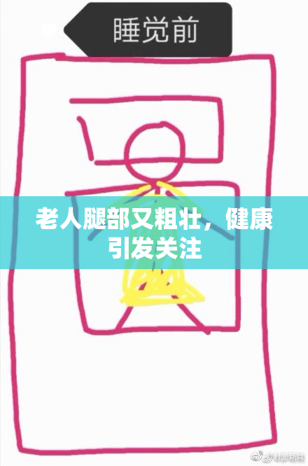 老人腿部又粗壮，健康引发关注