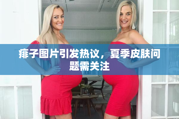 痱子图片引发热议，夏季皮肤问题需关注
