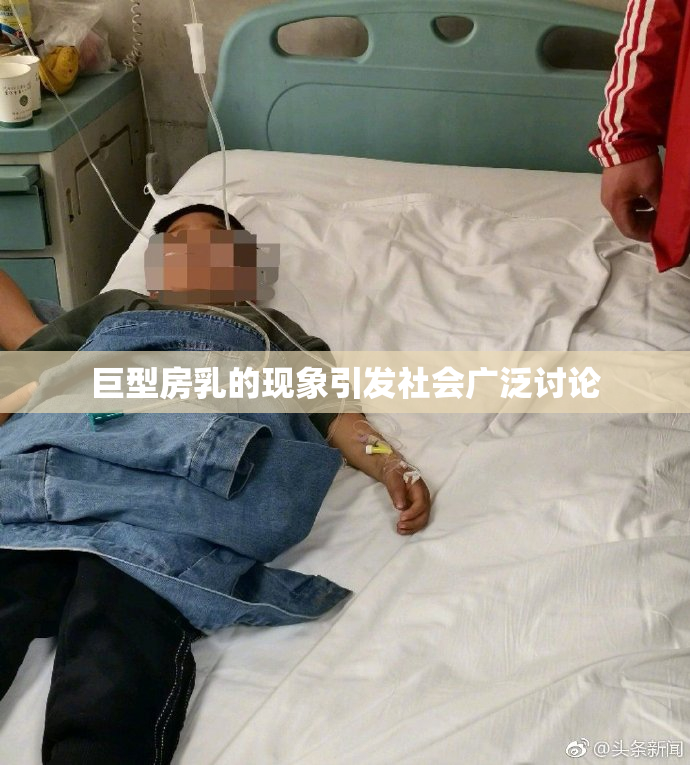 巨型房乳的现象引发社会广泛讨论